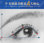 重慶北部寬仁醫(yī)院做眼綜合好不