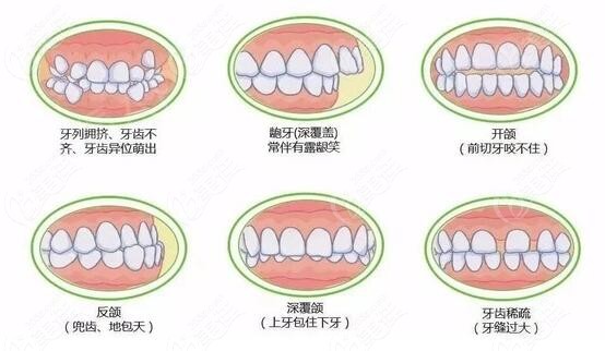 正畸面诊需要问什么问题