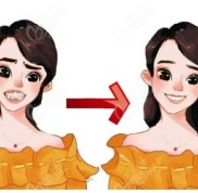 麗水牙齒矯正哪里好