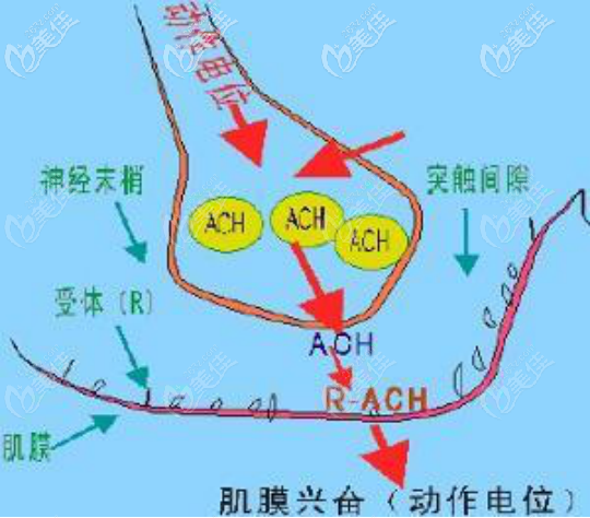 人中短上唇厚还外翻上翘要如何改善