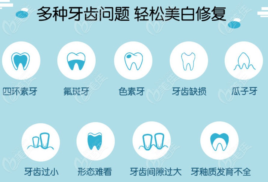 網傳美加超薄牙貼面的壽命能維持10年