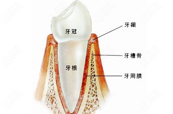 門(mén)牙缺失做全瓷牙還是種植牙