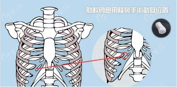 不要問(wèn)上海趙延峰做鼻子好嗎