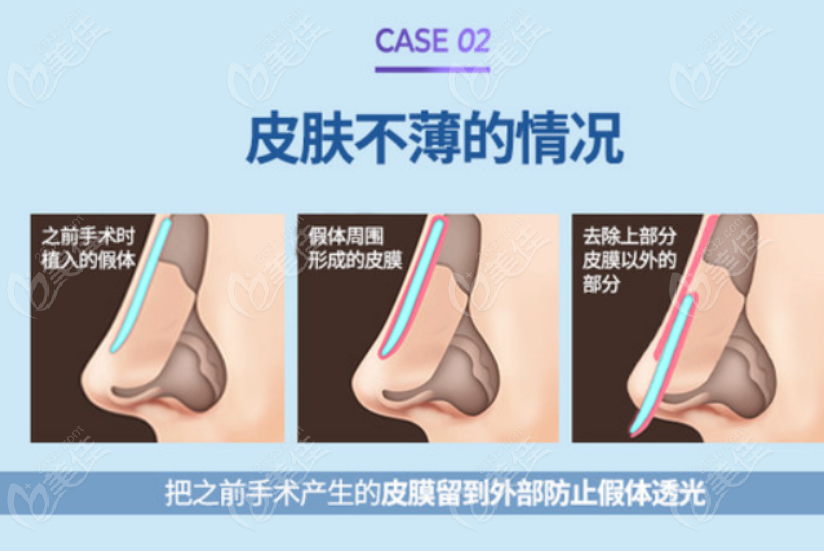 韓國整容價格一覽表發(fā)布