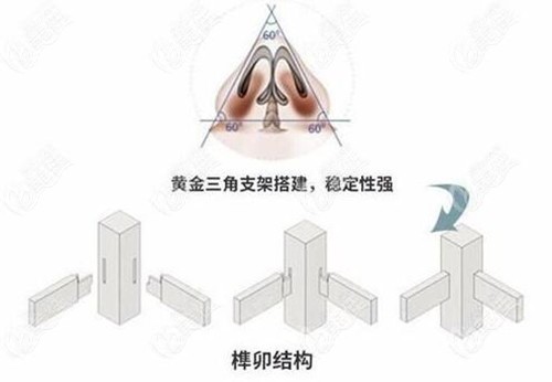 广西爱思特王楷医生做鼻子怎么样