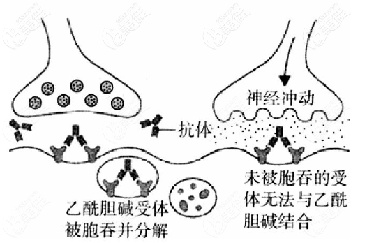 人中短上唇厚還外翻上翹要如何改善