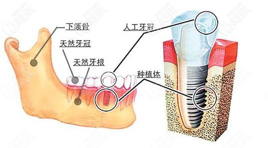 扒到了上清寺各口腔醫(yī)院價格明細