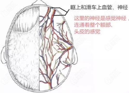 一文解答膨體假體墊眉弓后頭皮發(fā)麻怎么回事