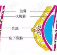 遼寧曙光整形醫(yī)院3D內(nèi)窺鏡假體隆胸效果還不錯(cuò)