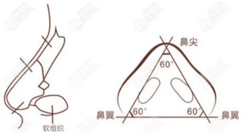 肋骨鼻哪家醫(yī)院做的好