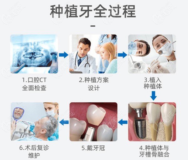 北京顺义博爱口腔价格表含有种植牙、牙齿矫正、拔牙等收费标准