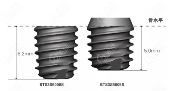 短种植体有哪些品牌