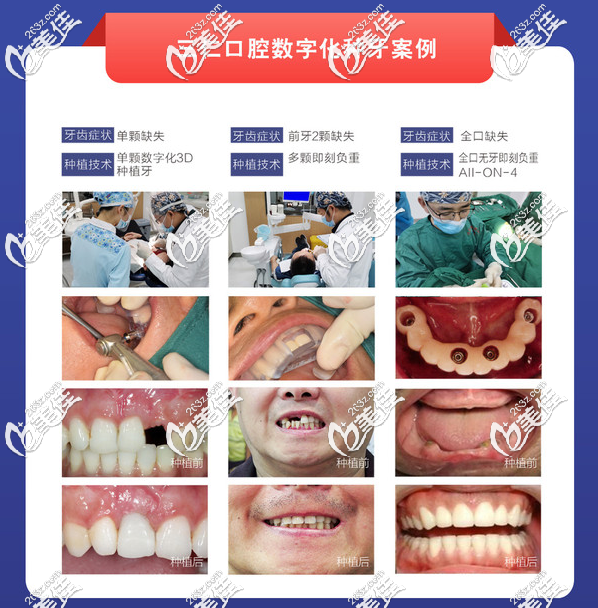 打卡广州三仁口腔医院