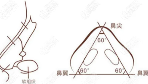 西安鼻修復(fù)做的好的醫(yī)生都有誰