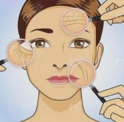 更新西寧拉皮醫(yī)院排名以及做面部拉皮手術(shù)多少錢一次
