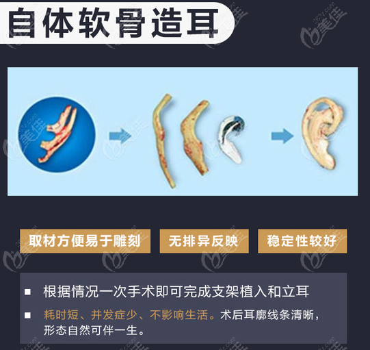 淺談耳畸形再造手術(shù)醫(yī)保能否報銷