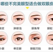 大理割雙眼皮哪家醫(yī)院好