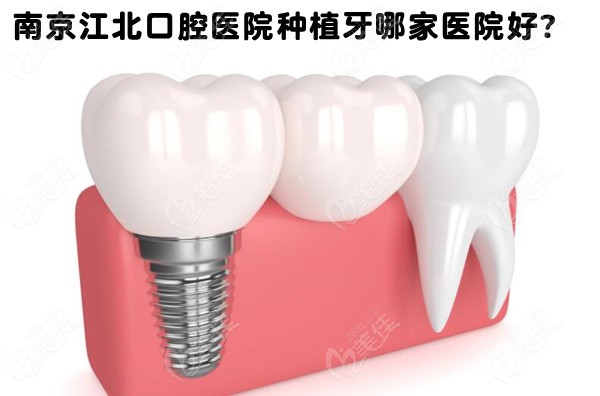 南京江北口腔医院种植牙价格表及种牙比较好的医院正在派送