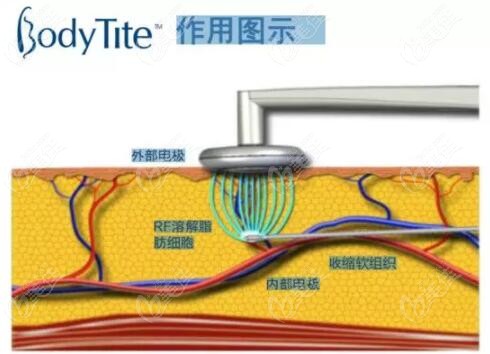 二十歲左右可以做黃金微雕嗎