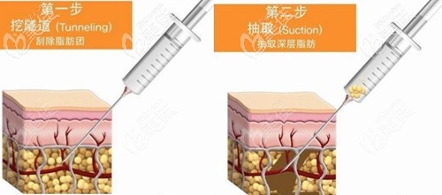 韓國365mc無限蘭斯價(jià)格是不是很貴