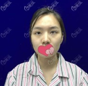 只知道南寧奢梵整形包國宏醫(yī)生鼻子做的好