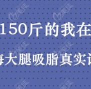 150斤在上海做大腿吸脂的真實(shí)記錄