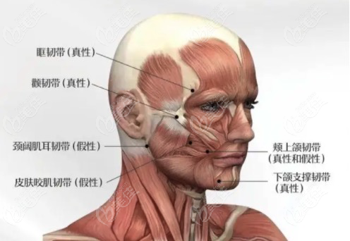 面部韧带提升可以取出吗