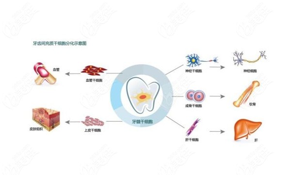 解析牙髓血管再生术的步骤、适应症、费用以及成功率