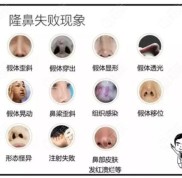 這份沈陽做鼻修復(fù)正規(guī)醫(yī)院名單中