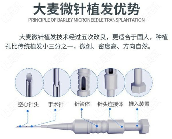 哈尔滨植发医院哪家好