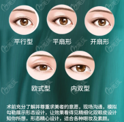 安慶割雙眼皮哪家醫(yī)院好