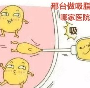 邢臺做吸脂手術(shù)哪家醫(yī)院好