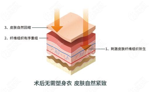 土麥森吸脂是什么價格