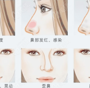 鄭州鼻修復(fù)好的正規(guī)醫(yī)院排行榜出了