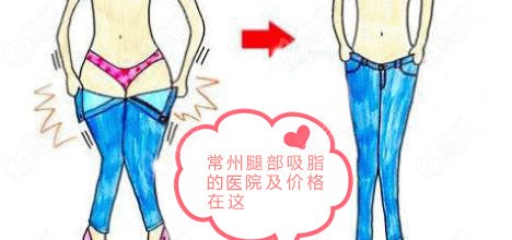 从各家给出的常州大腿吸脂费用来了解下常州腿部吸脂哪家好