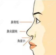 寧波薇琳做鼻子哪個(gè)醫(yī)生好