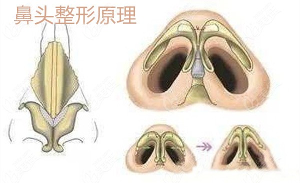 呼市華醫(yī)的宋耀宗醫(yī)生做鼻子怎么樣呢