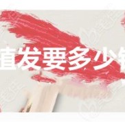 荊州植發(fā)要多少費(fèi)用