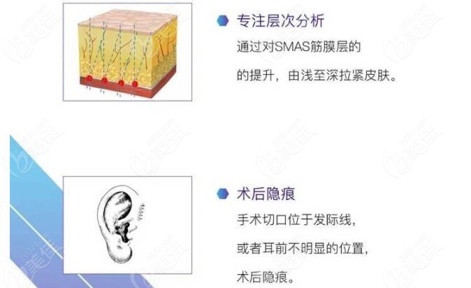 包头做拉皮手术哪个医院好