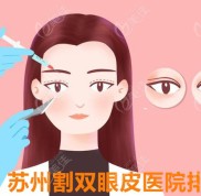 蘇州割雙眼皮醫(yī)院的排名榜