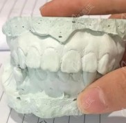 南京鼓樓美奧口腔隱形矯正靠譜嗎