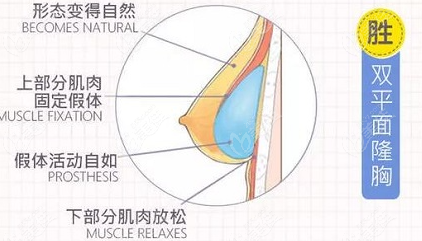 南昌佳美張效恩隆胸手術(shù)技術(shù)怎么樣