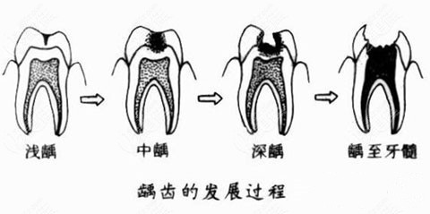 原來除了補牙/拔智齒牙