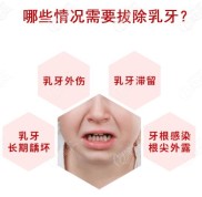 想知道長沙拔牙齒一般多少錢就看這