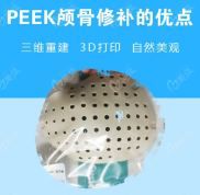 國(guó)內(nèi)后腦勺填充比較好的醫(yī)院要數(shù)上海時(shí)光