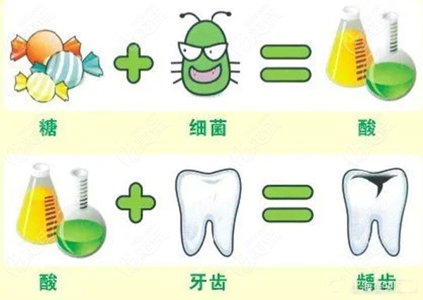 引起牙體楔狀缺損的原因并非只有橫向刷牙