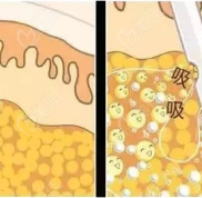上海吸脂手術(shù)效果排名前五的醫(yī)院
