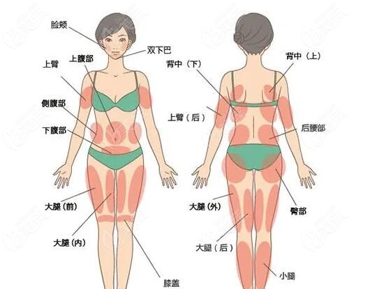 做全身抽脂一次性可以抽多少斤脂肪