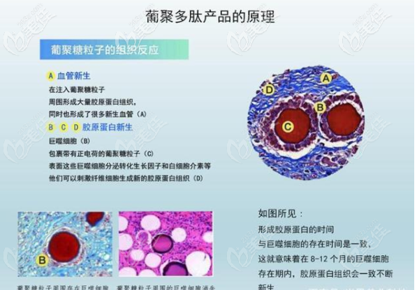 打一支葡聚多肽多少錢呀