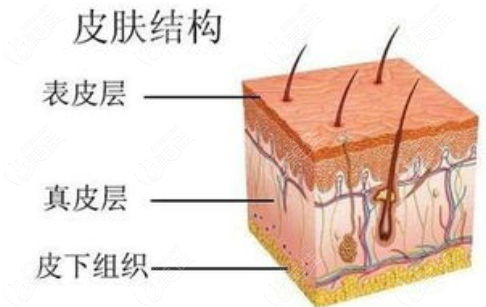 分析速提美和微創(chuàng)筋膜懸吊術(shù)區(qū)別有哪些